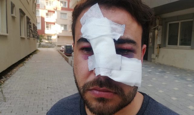 Bir Müzisyene daha "istek şarkı" şiddeti!