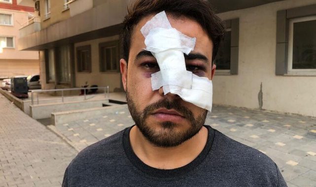Bir Müzisyene daha "istek şarkı" şiddeti!