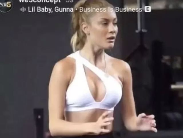 Acun Ilıcalı'nın sevgilisi Çağla Altunkaya göğüslerine estetik mi yaptırdı?