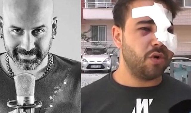Bir Müzisyene daha "istek şarkı" şiddeti!
