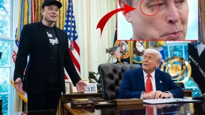 Elon Musk'ın gözünü kim morarttı?