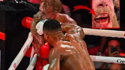 Anthony Joshua maçında Jake Paul'un çenesi kırıldı