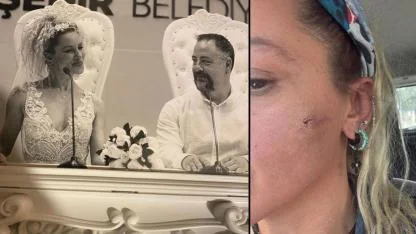 Ünlü oyuncu Yıldız Asyalı: Kocam tarafından darp edildim