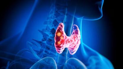 Tiroid: Vücudunuzun sessiz orkestra şefi (ama şefi kim yönetiyor?)