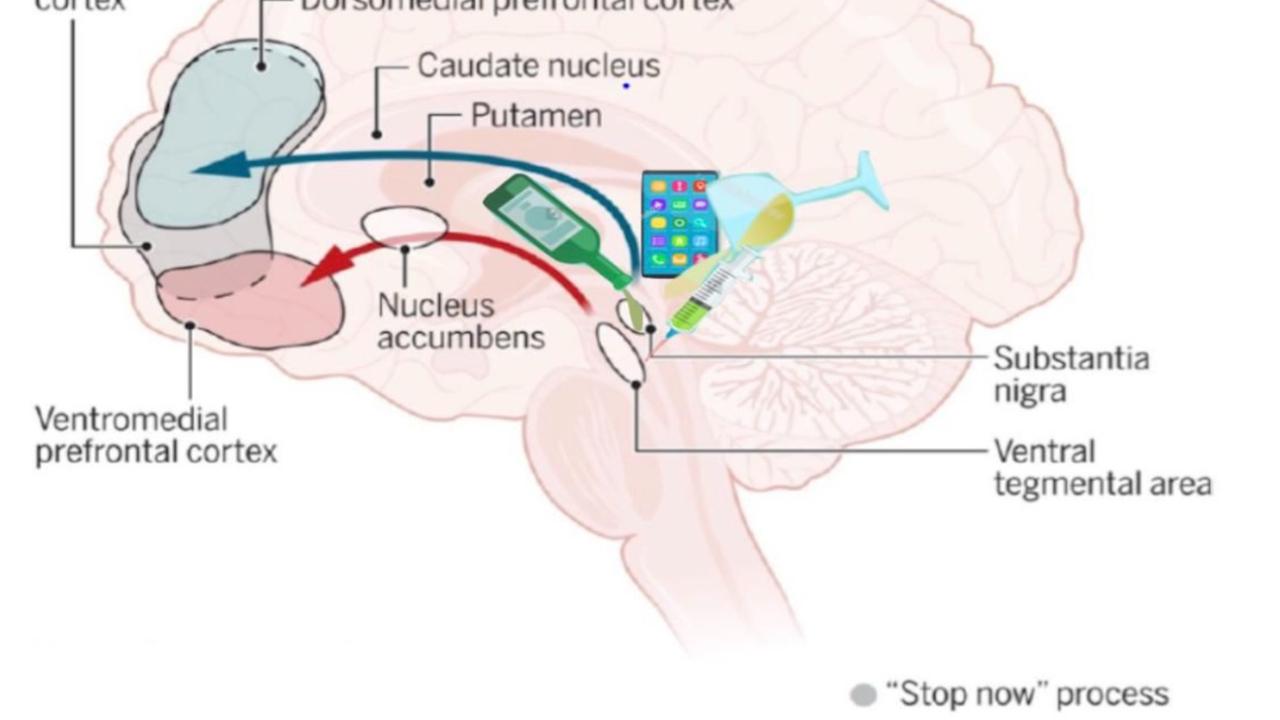 "Bağımlılık beyinde kayıtlı bir davranıştır" Neurofeedback üzerine bir röportaj