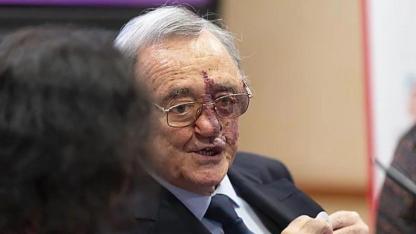 Pankreas kanserinde tarihi başarı... En ölümcül kanser türü tamamen yok edildi