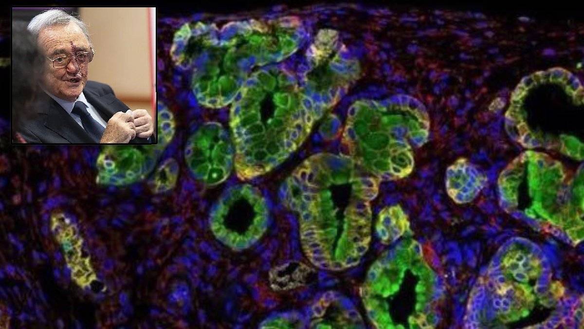 Pankreas kanserinde tarihi başar! En ölümcül kanser türü hayvan tamamen yok edildi